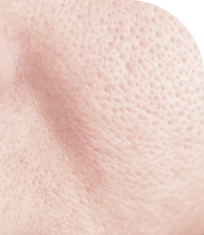 毛穴が目立つ肌のクローズアップ写真