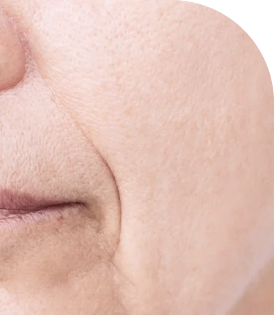 口元と肌のクローズアップ。「クールフェイス」のスキンインフォ画像。