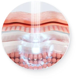 肌の断面図に光線が差し込むイメージ図