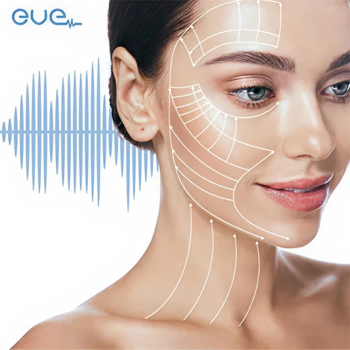女性の顔に、美容施術のガイド線と音波の図が重ねて表示されている。