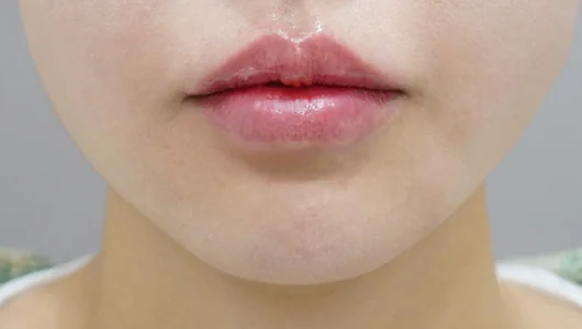ふっくらとした、ツヤのある唇のアップ。