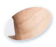 首の皮膚のクローズアップ、首シワフィラーのイメージ