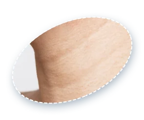 首のシワを強調した、楕円形のイメージです。