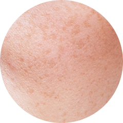 肌の質感を示す円形の画像。