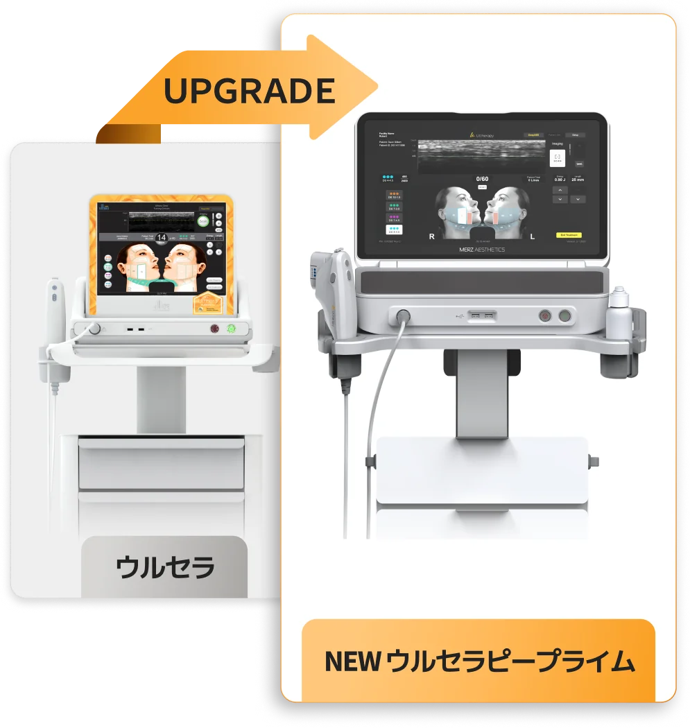 ウルセラからウルセラピープライムへのアップグレードを示す画像。